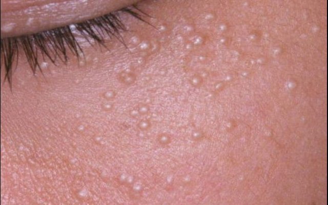 Skin cleaning: everything you need to know before doing it