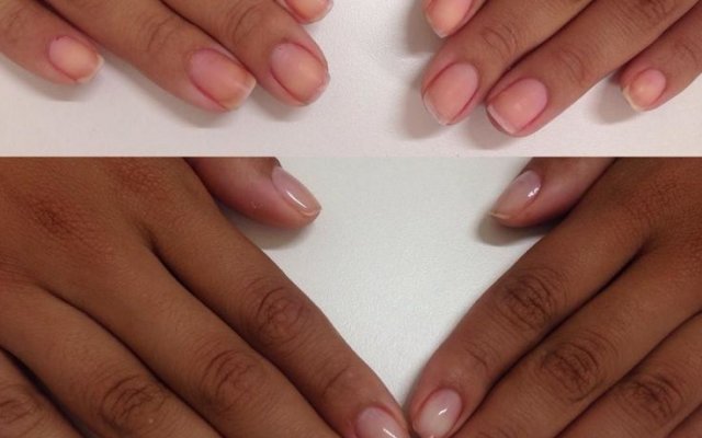 What is it, how is it done and what are the benefits of nail shielding