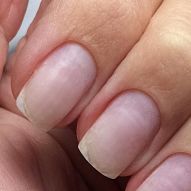 How to fix broken nail? Know 5 tricks to save you at these times!
